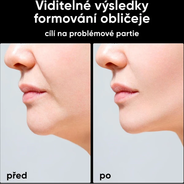 JOVS Slimax mikroprúdový omladzujúci prístroj - Čističe pleti - Obrázok 2186beaaac8047e48599212a35ddad09