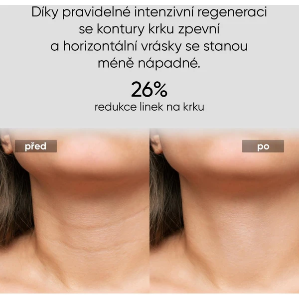 JOVS LED svetelná maska na krk a hrudník - Čističe pleti - Obrázok 42838d2f364743caa827607c87bc3872