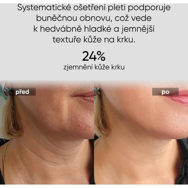 JOVS LED svetelná maska na krk a hrudník - Čističe pleti - Obrázok 5c8b1ede520f497ab2bf744737f267db