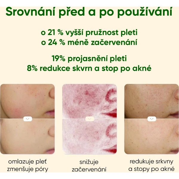 JOVS Blacken Pro DPL fotofacial prístroj na starostlivosť o pleť - Čističe pleti - Obrázok 6113364259b34947ab8ba580e2069b00