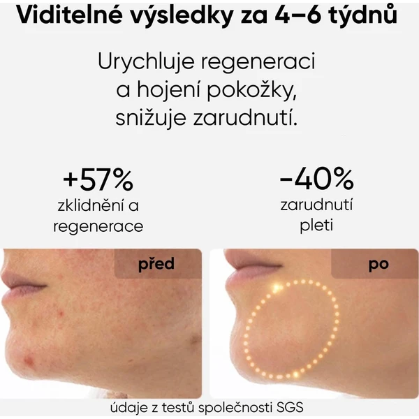 JOVS LED svetelná terapeutická maska na tvár - Čističe pleti - Obrázok 6eb7a7f021f94b0396c8758680102b60