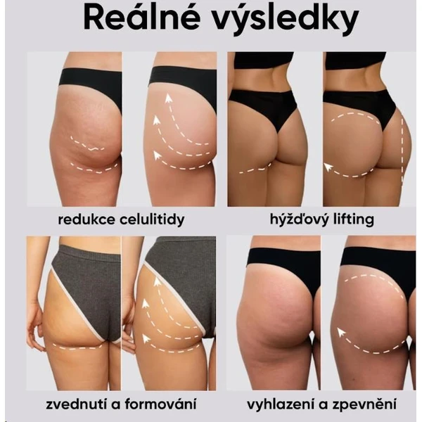 JOVS EMS tonizačné šortky (F+) - Čističe pleti - Obrázok 7b895163d7a44855bc9f04c082ff4d7e