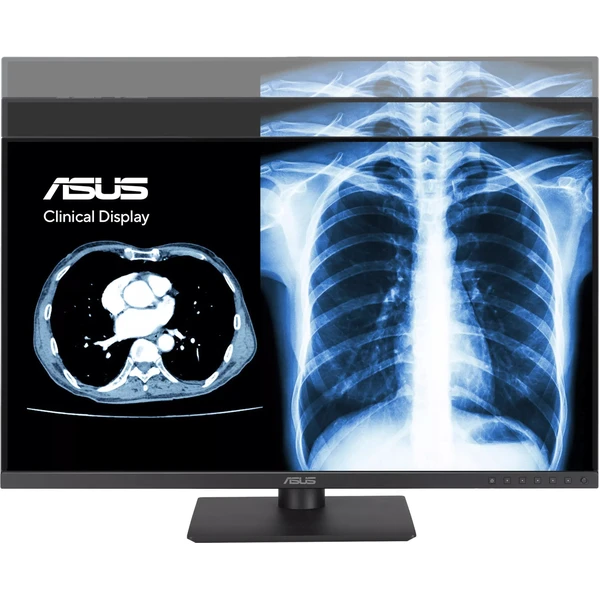 ASUS MH2441A klinický monitor 24" - Monitory - Obrázok XB4G000K01