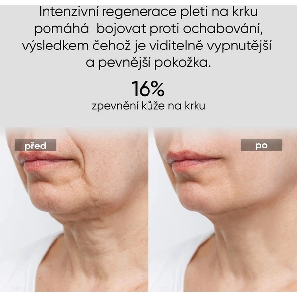 JOVS LED svetelná maska na krk a hrudník - Čističe pleti - Obrázok a73c08cd7d414dcb87600b4a7db5217a