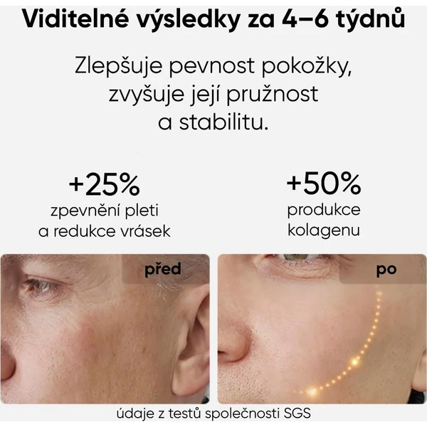 JOVS LED svetelná terapeutická maska na tvár - Čističe pleti - Obrázok b00f3c342d1643c3bab05552c9f97f9a