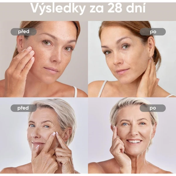 JOVS 4D v2 laserová svetelná terapeutická maska - Čističe pleti - Obrázok b7bad0c543e44c6b8e3d381a42ed4d57