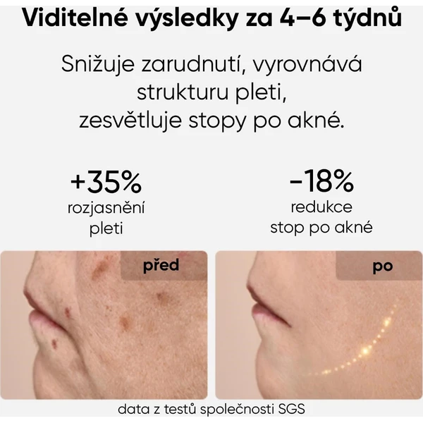 JOVS LED svetelná terapeutická maska na tvár - Čističe pleti - Obrázok c9cd8f0a82d340d18a3f094c8e0cf477