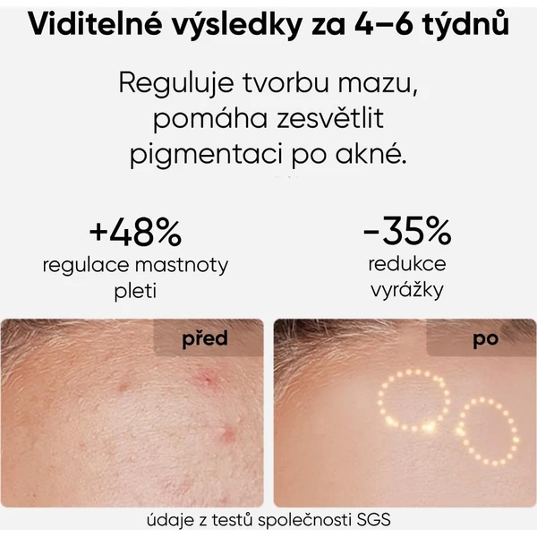 JOVS LED svetelná terapeutická maska na tvár - Čističe pleti - Obrázok f70c6bd50ea147be817bb87d51f22fa2